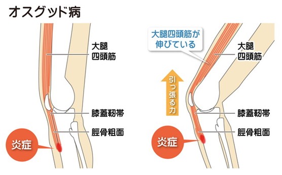 症状を知ろう